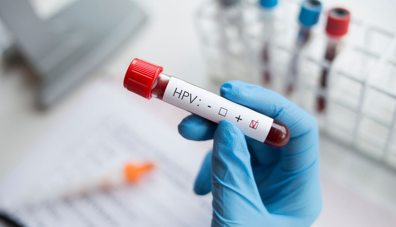 Xét nghiệm HPV bao lâu 1 lần? Lời khuyên cho từng đối tượng cụ thể 1