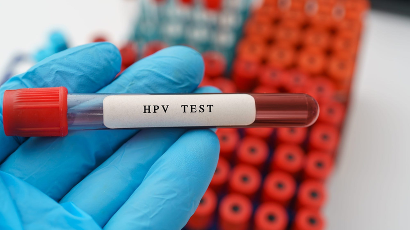 Xét nghiệm HPV bao nhiêu tiền? Quy trình như thế nào? 4