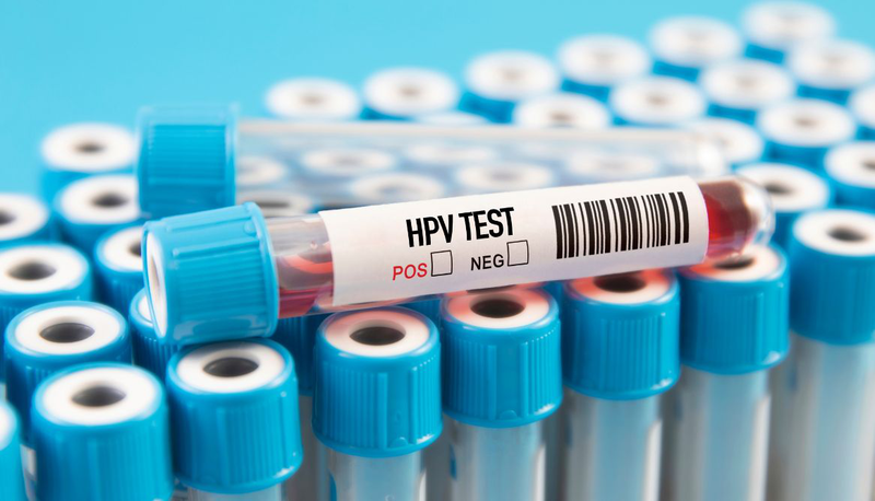 Xét nghiệm HPV cho nam ở đâu? Gợi ý các địa chỉ uy tín 1