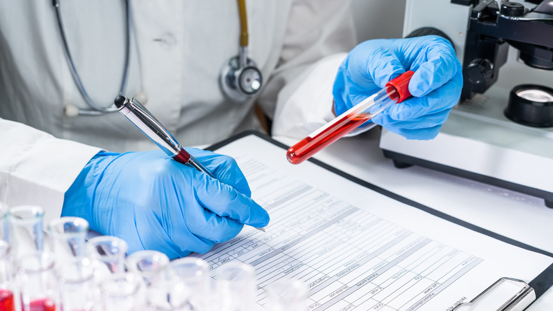 Xét nghiệm ion đồ máu là gì? Quy trình và ý nghĩa của xét nghiệm ion đồ máu