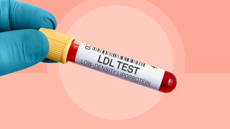 Xét nghiệm LDL là gì? Có quan trọng không? 1