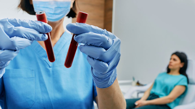 Chi phí xét nghiệm máu thường không quá cao