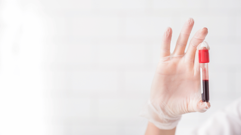 Xét nghiệm máu có được bảo hiểm chi trả không​? 3