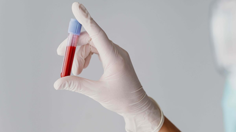 Xét nghiệm máu phát hiện ung thư sớm có đúng hay không? 3