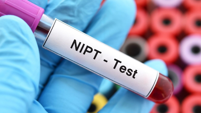 Xét nghiệm NIPT phát hiện những bệnh gì? 1