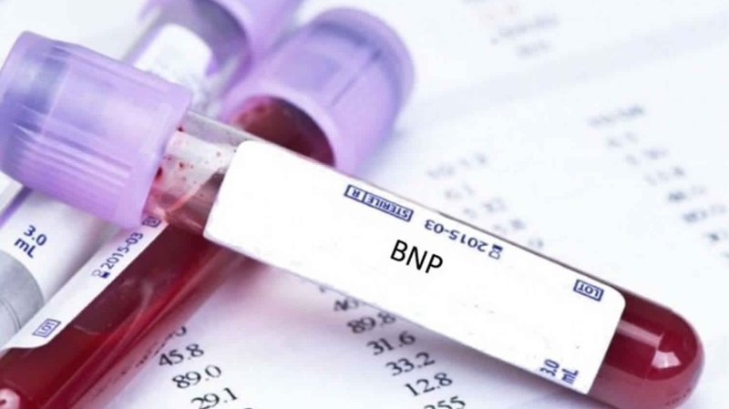 Xét nghiệm proBNP: Hướng dẫn chi tiết và tầm quan trọng trong chẩn đoán bệnh tim 1