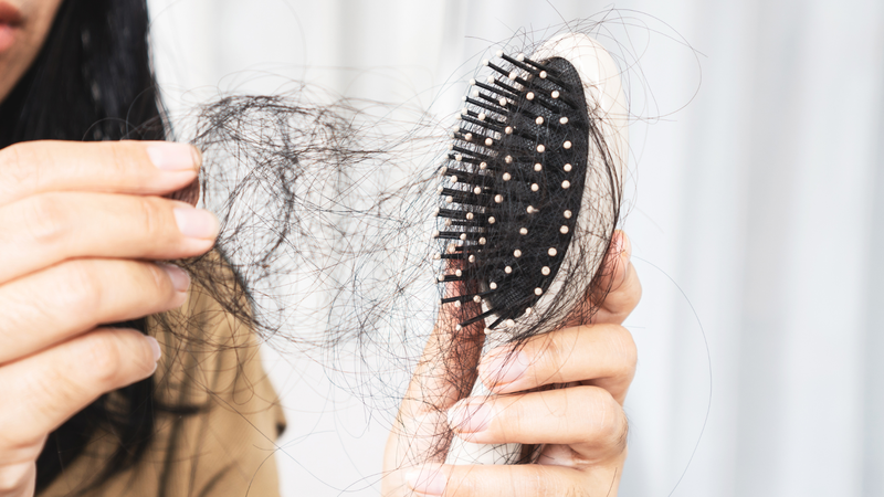 Xét nghiệm rụng tóc: Giải mã nguyên nhân và hướng điều trị chính xác 2