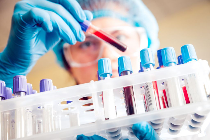 Xét nghiệm sắt huyết thanh và ferritin: Vai trò, khoảng tham chiếu và lưu ý trước khi thực hiện 2