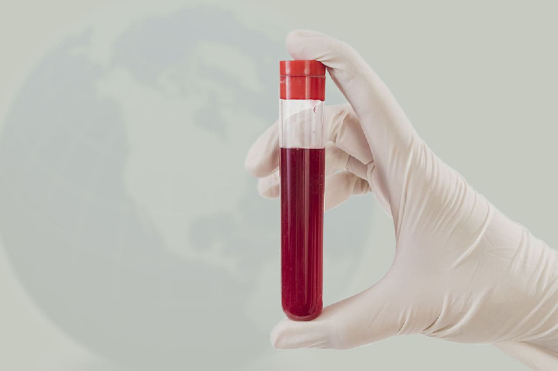 Xét nghiệm sinh sợi huyết trong đánh giá khả năng đông và cầm máu 4