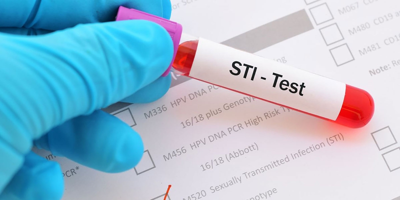 Xét nghiệm STI là gì? Những loại xét nghiệm STI phổ biến hiện nay