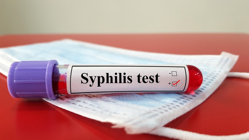 Xét nghiệm syphilis – Phương pháp sàng lọc bệnh giang mai hiệu quả 3