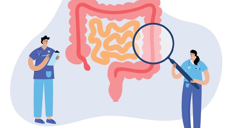 Xét nghiệm tầm soát ung thư đại tràng: Ý nghĩa, đối tượng và những xét nghiệm thông dụng 1