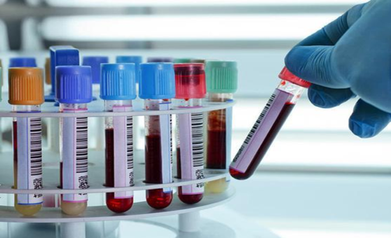 Xét nghiệm tổng phân tích tế bào máu để làm gì? 1