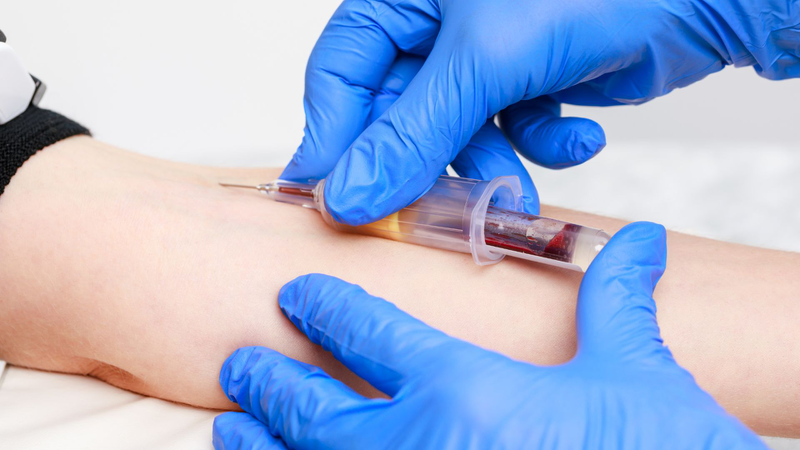 Xét nghiệm triglyceride chẩn đoán bệnh gì và cách đọc kết quả xét nghiệm 6