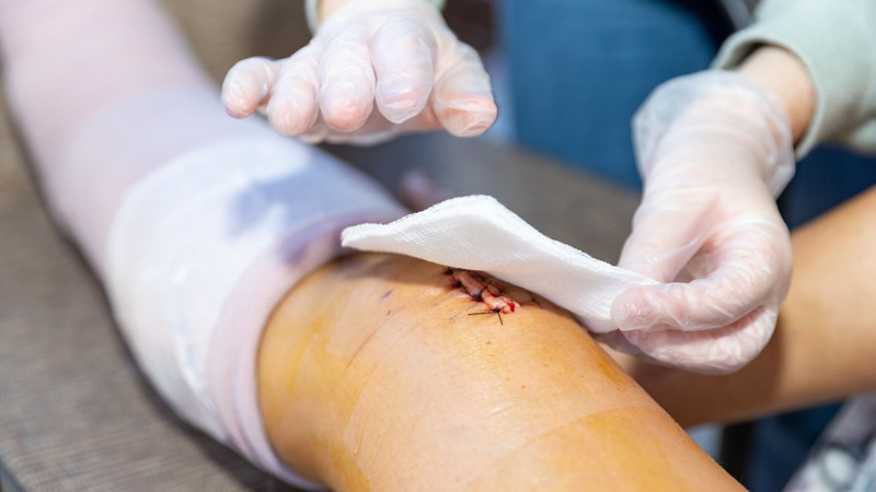 Có nhiều nguyên nhân khác nhau, gây ra các loại vết thương khác nhau