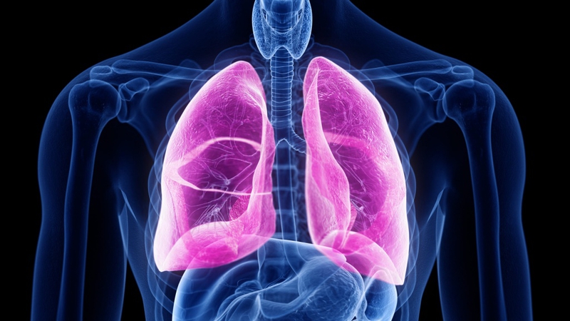 Xơ phổi có phải ung thư không? Hiểu đúng để điều trị hiệu quả 1