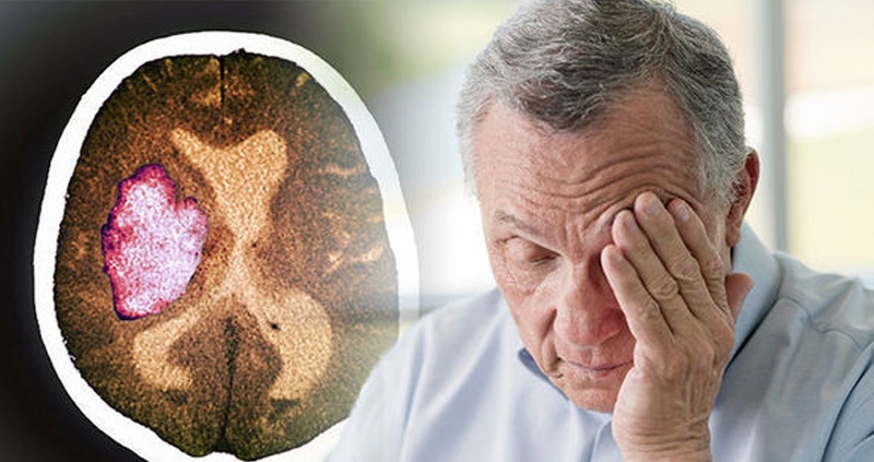 Xuất huyết não ở người già: Nguyên nhân, triệu chứng và cách điều trị 1
