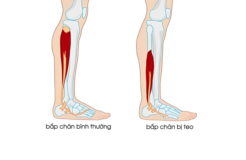 yeu-co-chan-5.jpg