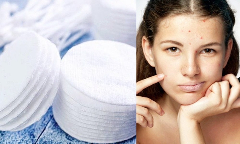 Sử dụng bông tẩy trang kém chất lượng hoặc thao tác quá mạnh trên da dễ dàng khiến da bị tổn thương, nổi mụn