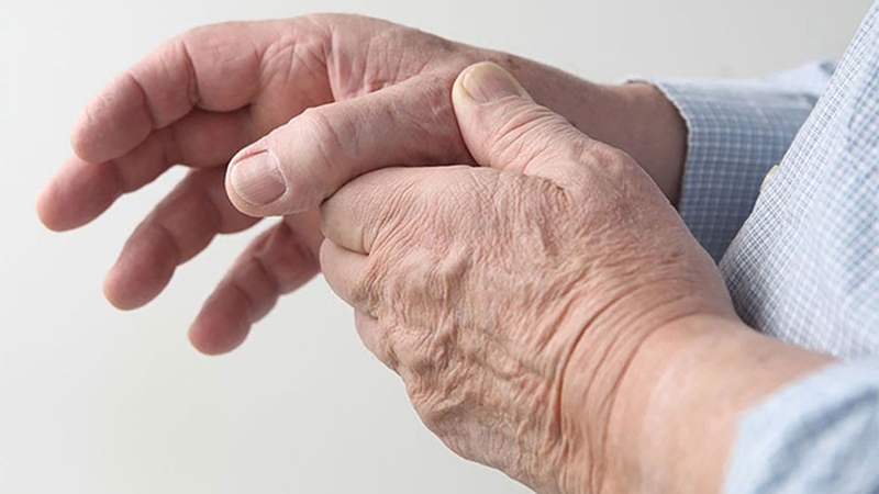Hướng dẫn các cách giảm đau do viêm khớp vảy nến không phải ai cũng biết 2