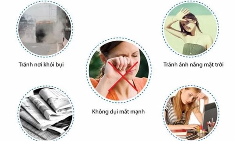 Hướng dẫn các chị em chăm sóc sau cắt mí2