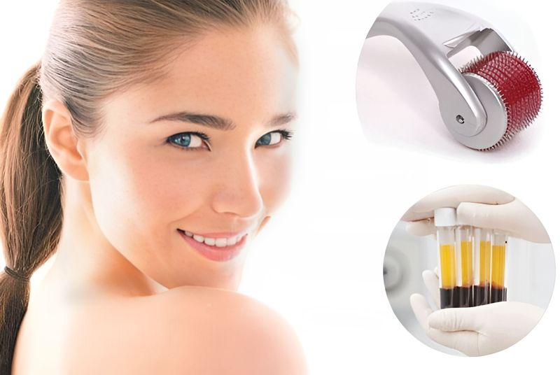 Hướng dẫn cách chăm sóc da sau lăn kim PRP đúng chuẩn 1