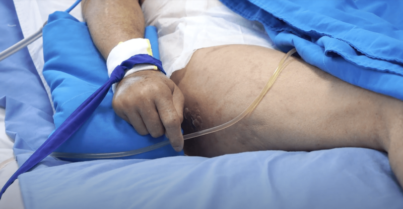 Hướng dẫn cách chăm sóc loét tì đè tại nhà