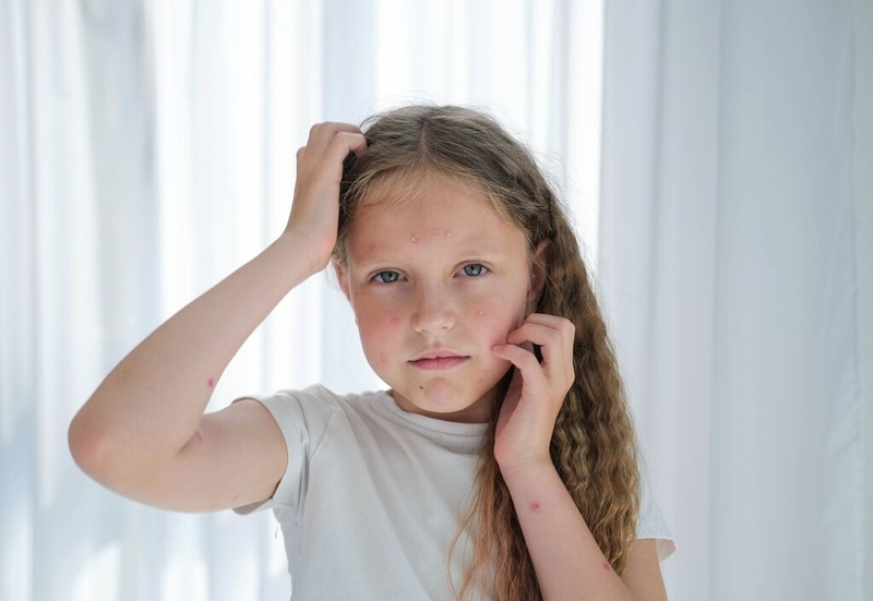 Hướng dẫn cách chữa bệnh viêm da ở trẻ em không phải cha mẹ nào cũng biết 1