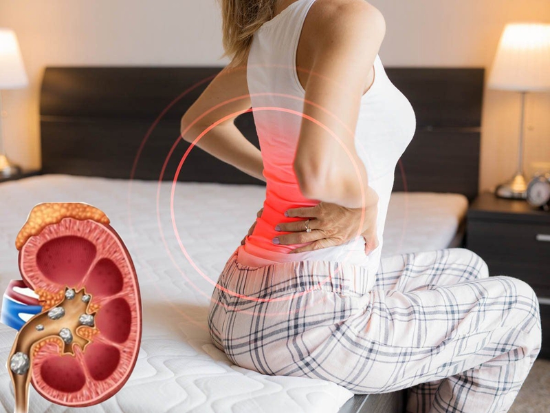 Hướng dẫn cách chữa sỏi thận bằng quả dứa 2