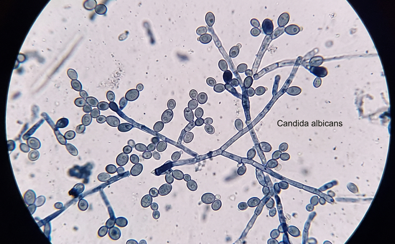 Nấm men Candida là tác nhân phổ biến gây sưng vùng nhạy cảm