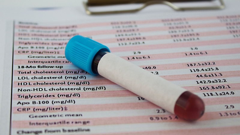 HDL, LDL, triglyceride hay cholesterol toàn phần là những thành phần trong xét nghiệm cholesterol