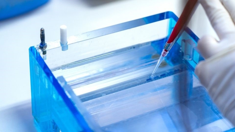 huong-dan-cach-doc-ket-qua-dien-di-dna 1