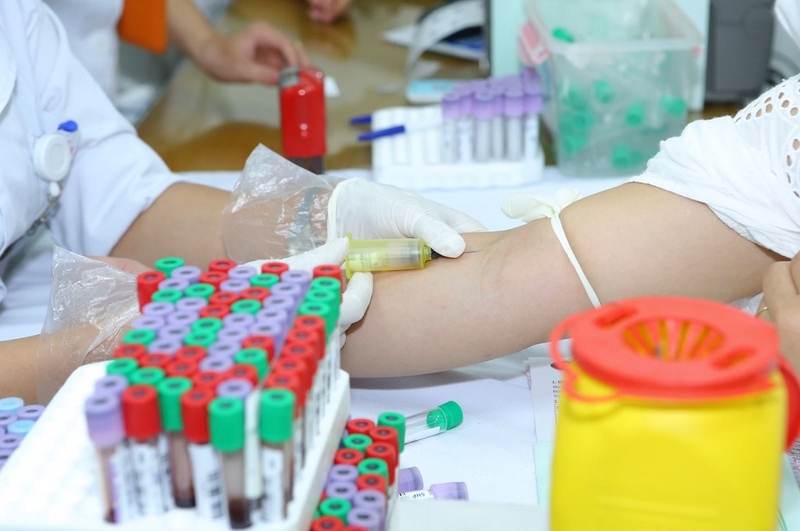 Hướng dẫn cách đọc kết quả định lượng virus viêm gan C bạn cần biết 4