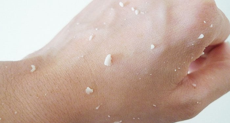 huong-dan-cach-ki-sach-ghet-bam-lau-ngay-tren-da-cuc-chi-tiet 1.png