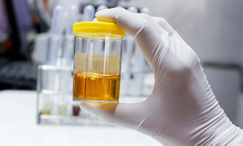 Hướng dẫn cách làm giảm protein trong nước tiểu khi mang thai 1