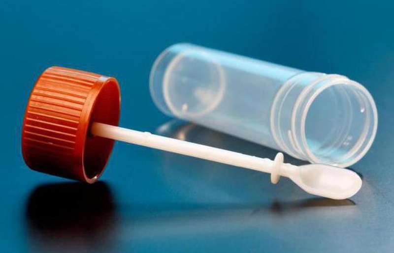 Quy trình lấy mẫu xét nghiệm phân và trực tràng