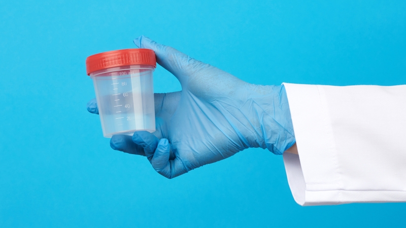 Hướng dẫn cách lấy nước tiểu cho nữ dễ hiểu và an toàn 1