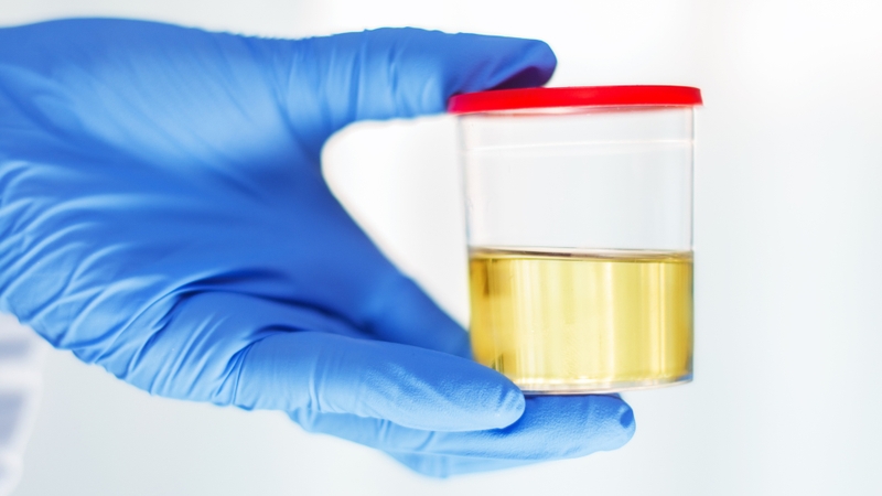 Hướng dẫn cách lấy nước tiểu cho nữ dễ hiểu và an toàn 3