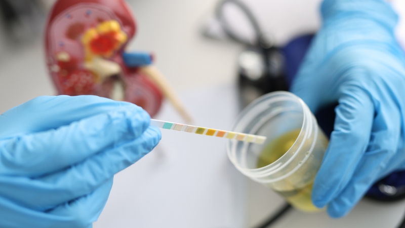 Hướng dẫn cách lấy nước tiểu cho nữ dễ hiểu và an toàn 4