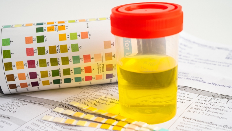 Hướng dẫn cách lấy nước tiểu cho nữ dễ hiểu và an toàn 5