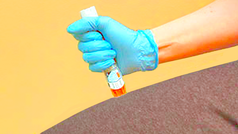 Hướng dẫn cách sơ cứu khi bị ong vàng đốt 3