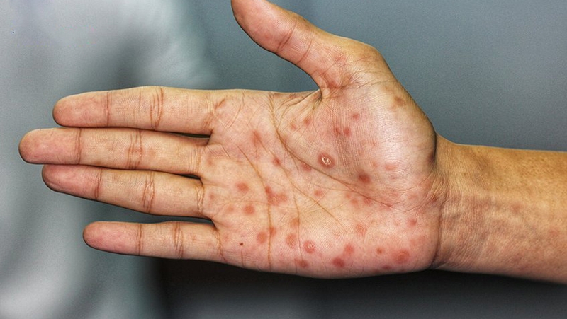 Hướng dẫn cách sử dụng nhà vệ sinh công cộng giúp tránh bệnh tật 1