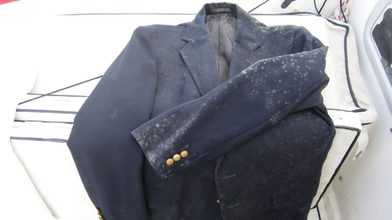 Hướng dẫn cách trị quần áo bị mốc hiệu quả không ngờ 1