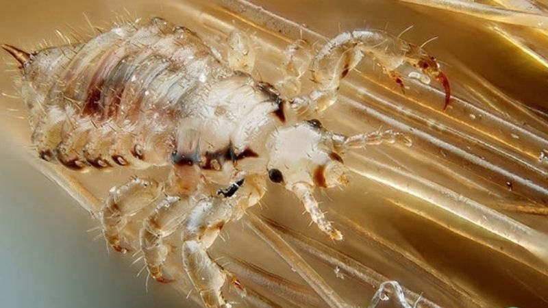 Hướng dẫn cách trị rận mu tại nhà hiệu quả 1