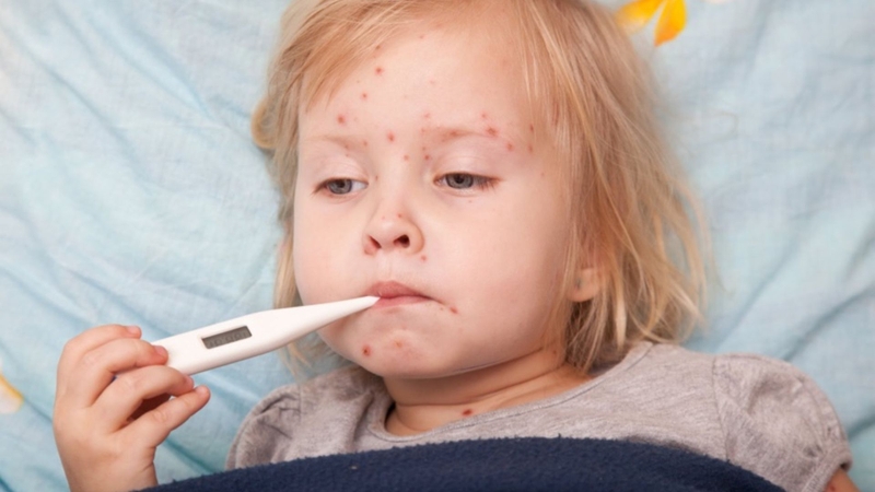 Hướng dẫn vệ sinh cho trẻ bị tay chân miệng đúng cách để phòng ngừa lây lan 1