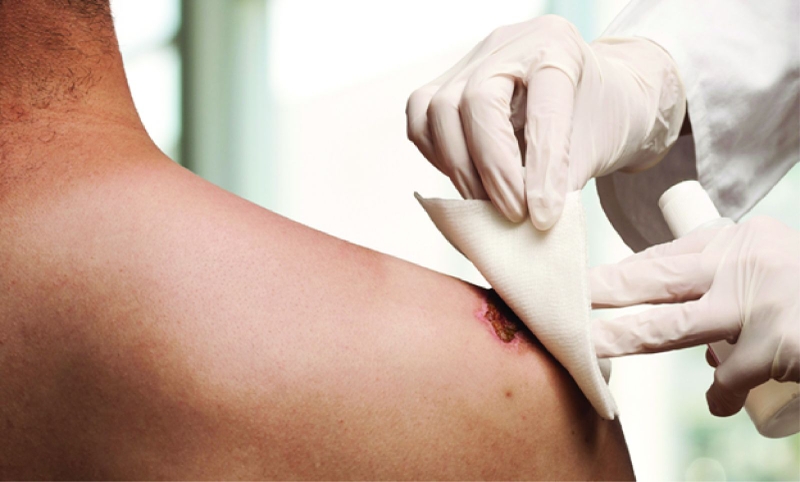 Hướng dẫn chi tiết chăm sóc vết thương sau mổ tại nhà