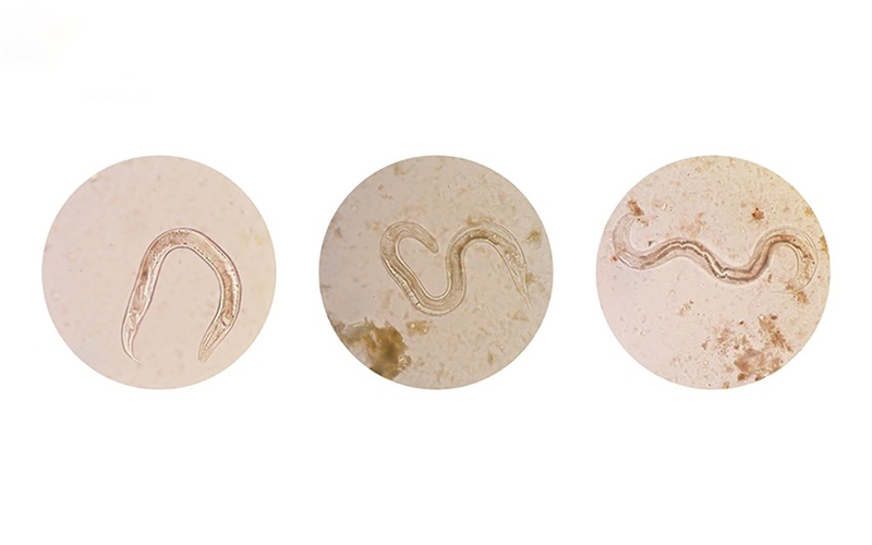 Hướng dẫn điều trị theo phác đồ điều trị giun lươn bộ y tế ban hành 1