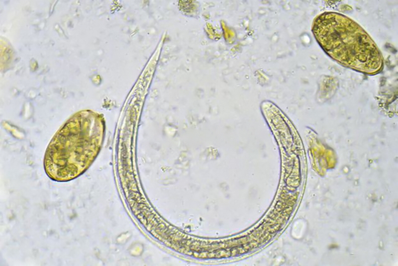 Hướng dẫn điều trị theo phác đồ điều trị giun lươn bộ y tế ban hành 3