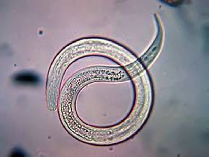 Hướng dẫn điều trị theo phác đồ điều trị giun lươn bộ y tế ban hành 4