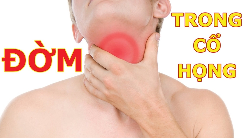 Hướng dẫn lấy đờm làm xét nghiệm chẩn đoán bệnh lao1